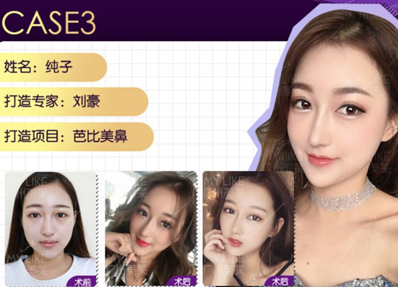 经典案例~纯子